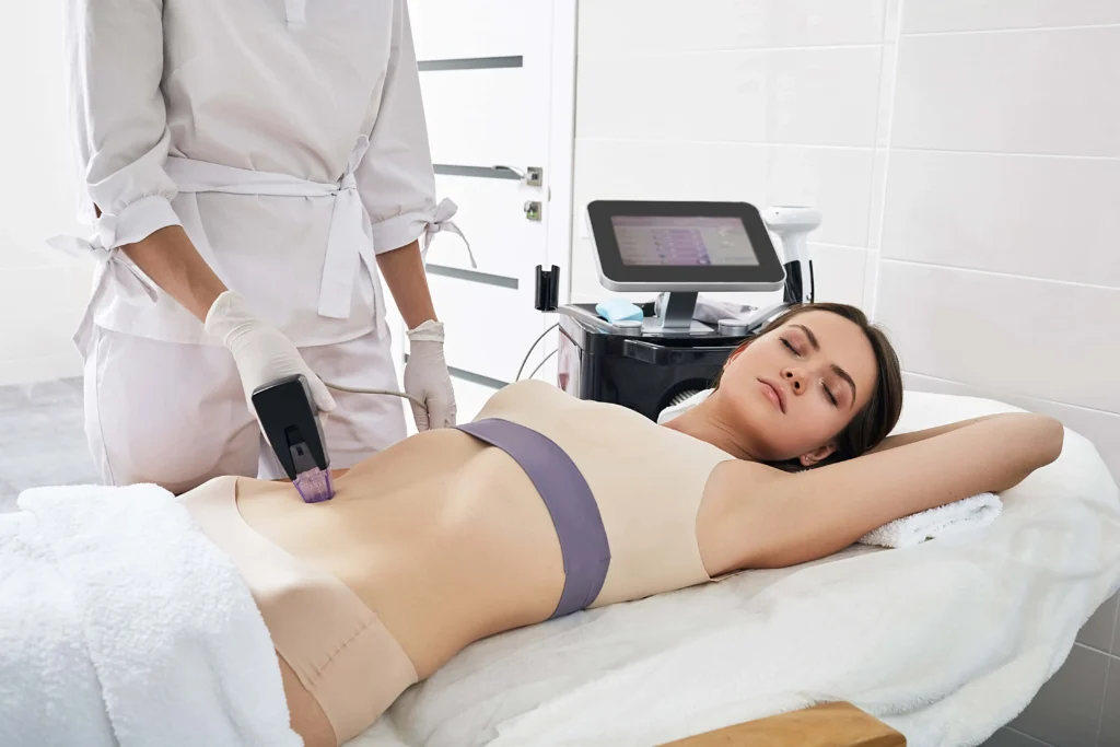 Morpheus8 body contouring treatment targeting the abdomen at Optimal Health Family Practice & Medspa