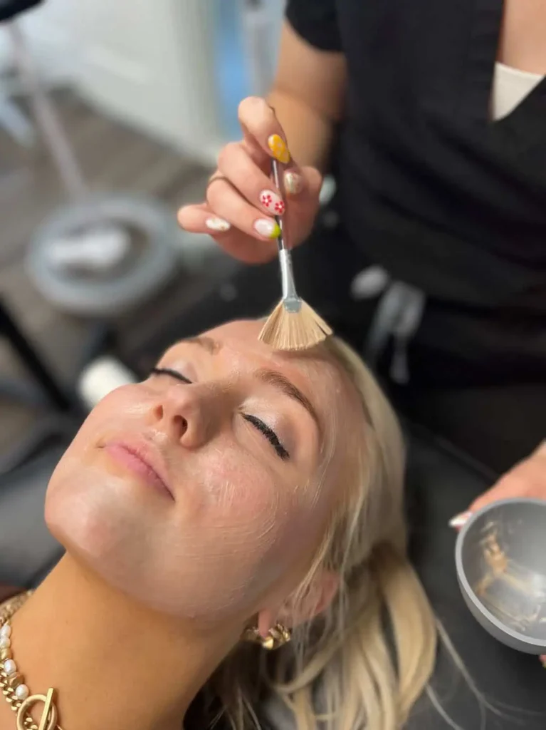 Woman receiving a chemical peel treatment on her face with a brush in Provo, UT.