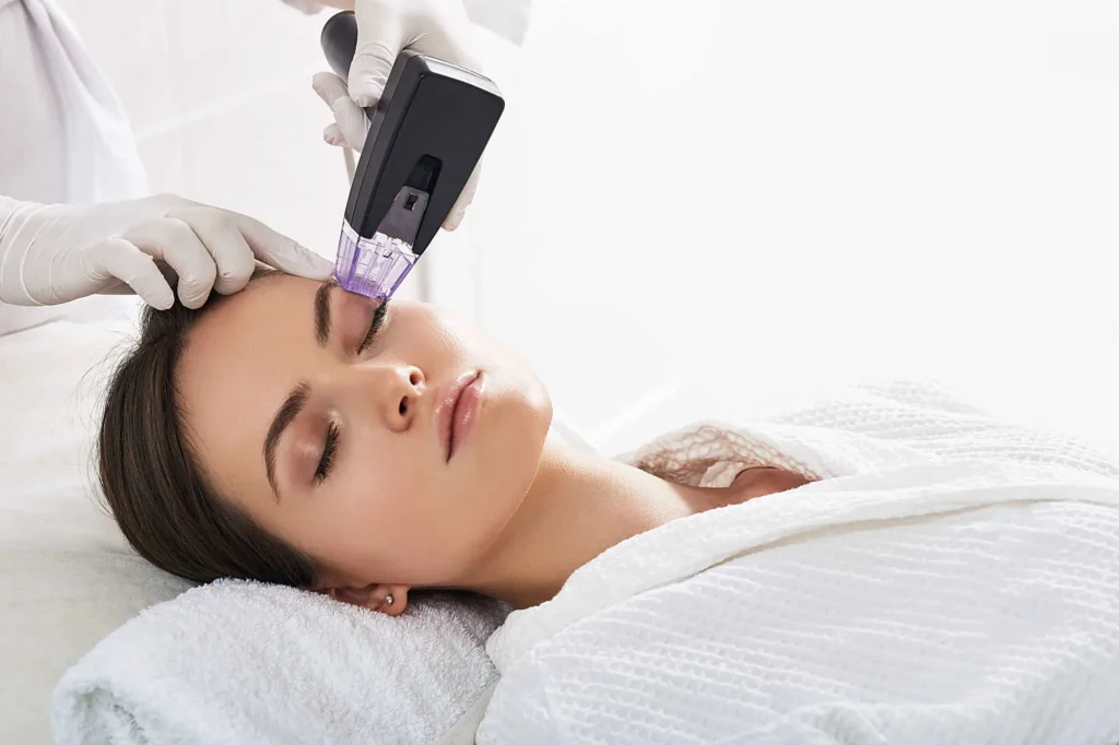 Patient receiving Morpheus8 treatment at a Provo, Utah, medspa clinic.