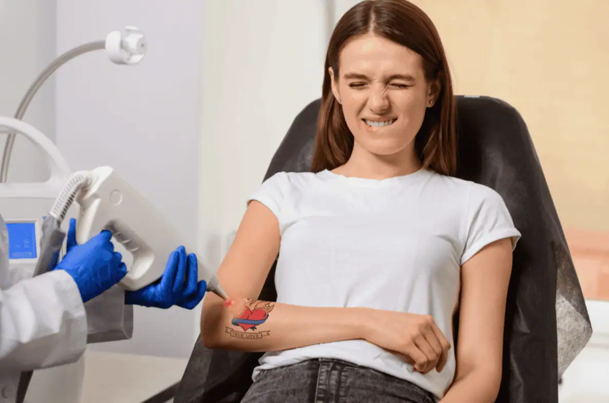 Laser Tattoo Removal in Provo UT by Optimal Health Family Practice & Medspa