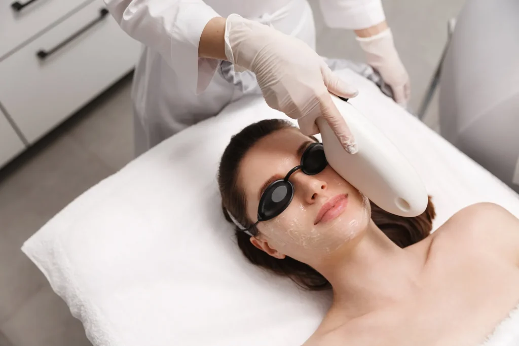 Woman with protective goggles receiving a BBL photofacial treatment on her face in Provo, UT.