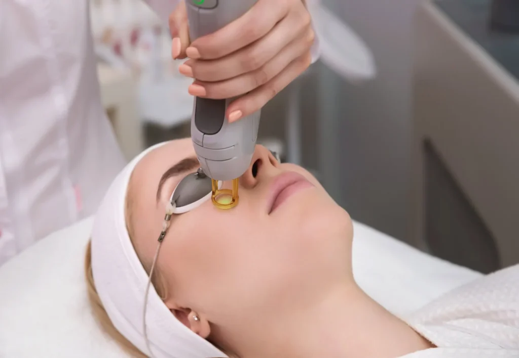 Woman receiving a Moxi laser treatment on her face while wearing protective goggles in Provo, UT.
