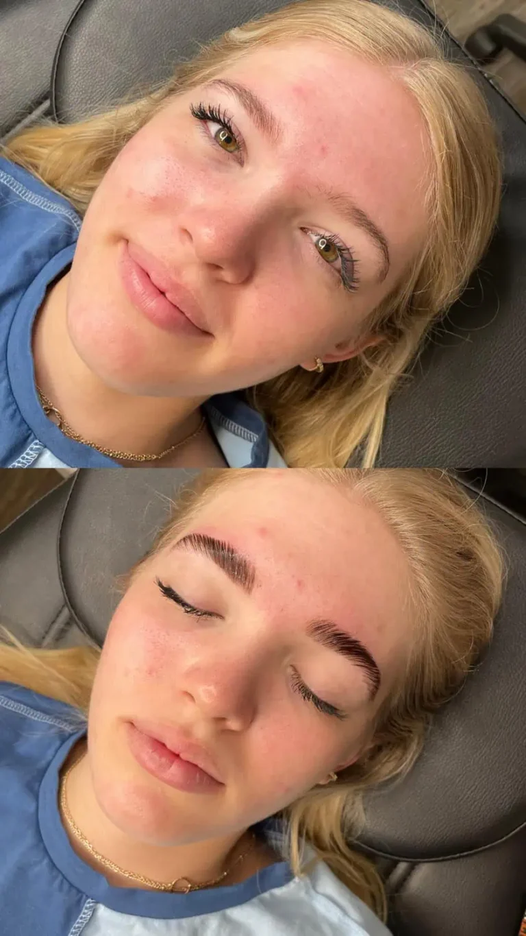 Before-and-After-img-hair-in-Optimal-Health-Family-Practice-Medspa-Provo-UT