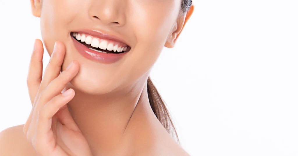 Close-up of a woman smiling with bright white teeth highlighting the results of professional Teeth Whitening in Provo, UT.