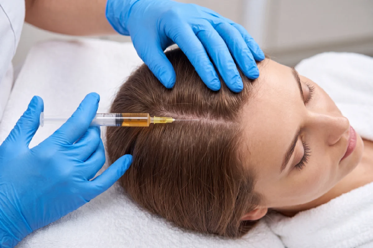 PRP hair restoration treatment for hair thinning at Optimal Health Family Practice & Medspa