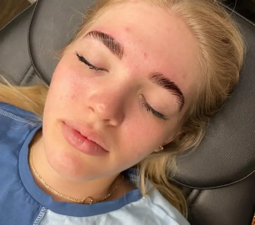 Brow lamination, after